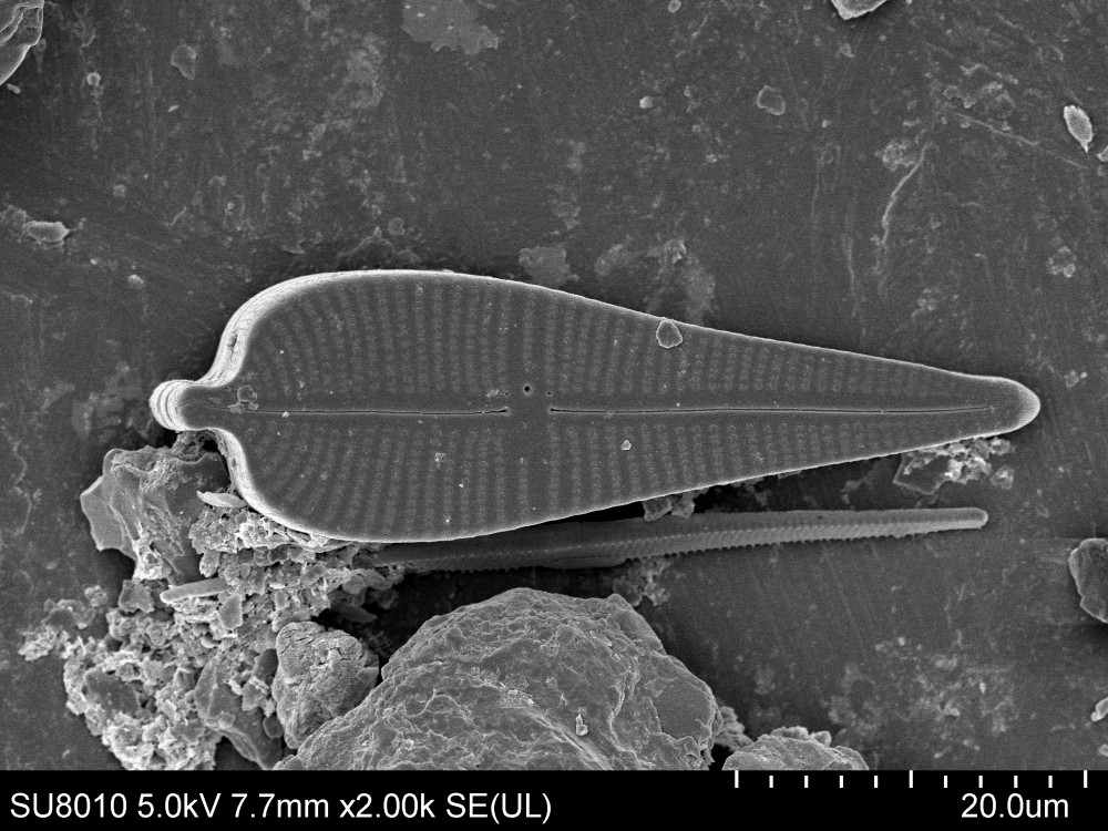 Gomphonema Ehrenberg
